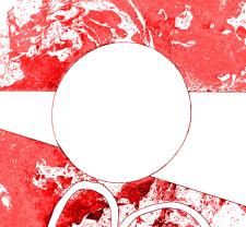 Dark Mimosa en concert au Gran Lux